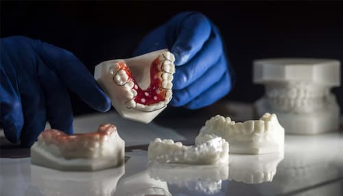 Making Teeth With 3D Printer: The New Trend